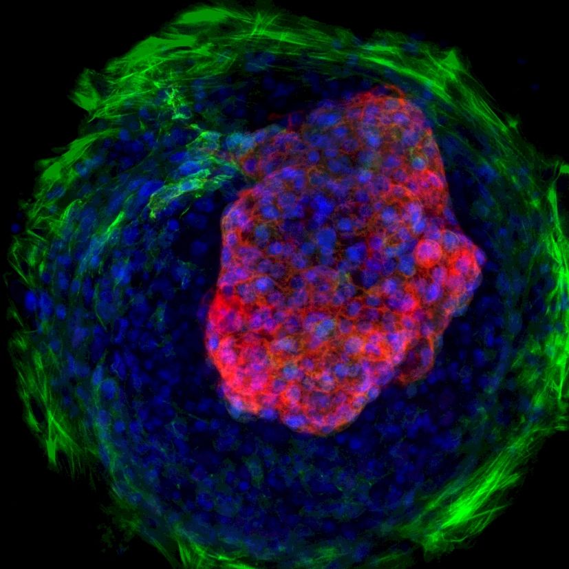 This image shows the heart-like “microchamber” that the researchers created from human induced pluripotent stem cells.