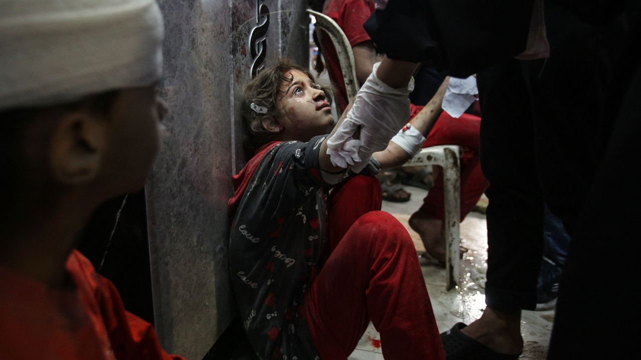 A young girl injured in an Israeli airstrike is treated at Al-Shifa hospital