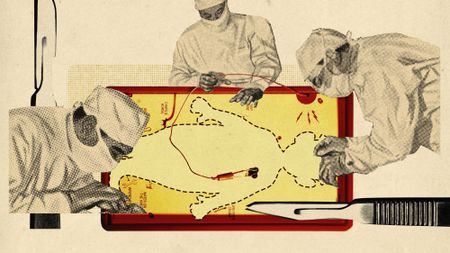 Photo collage of the game of Operation, with the man missing from it. Around it, there's illustrations of surgeons cutting into the empty table