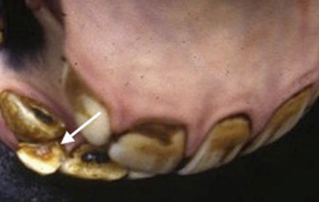 Retained deciduous incisor tooth (white arrow)