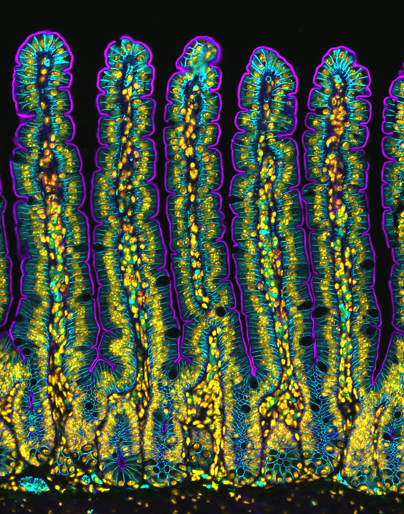 Section of a small intestine of a mouse