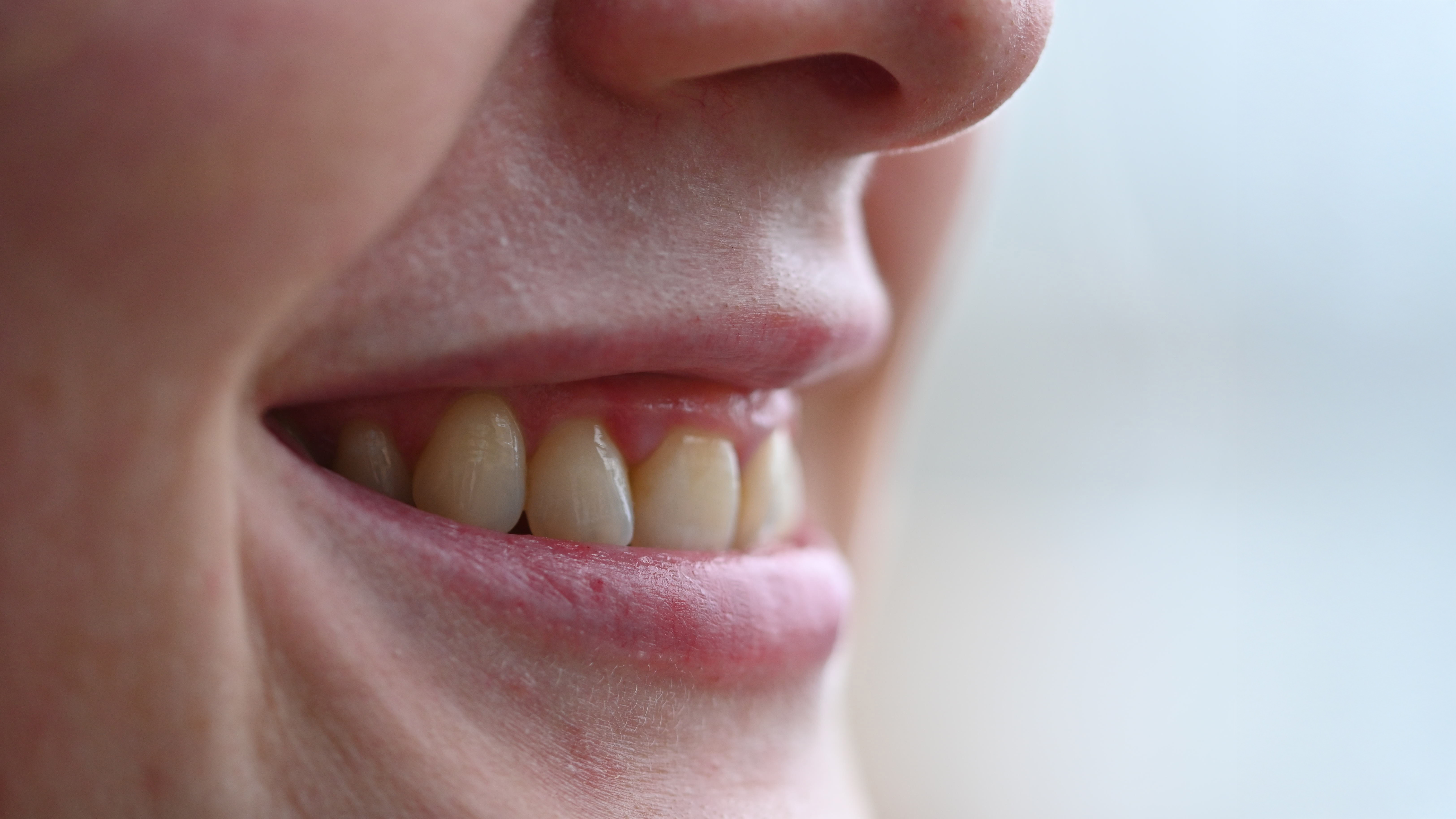 Close up shot of the mouth, but from a different angle