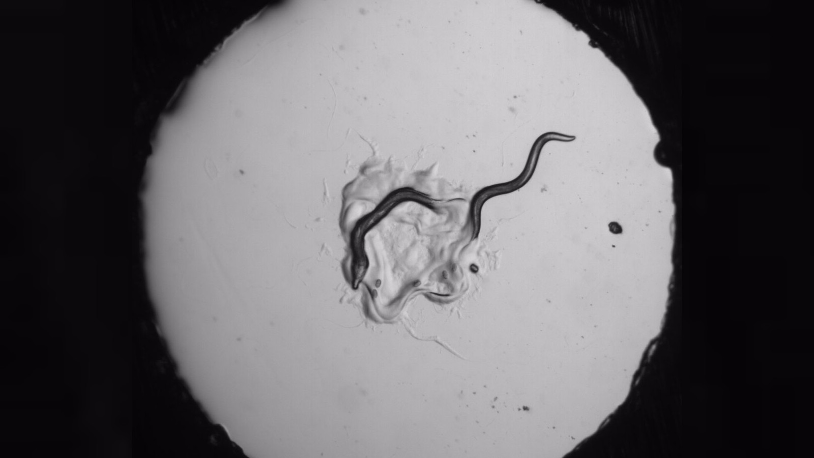 Черные черви в воде. Микроскопические глисты. Микроскопический червь в воде. Червячки микроскопические.