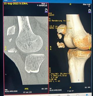 Tom Golag's knee scan