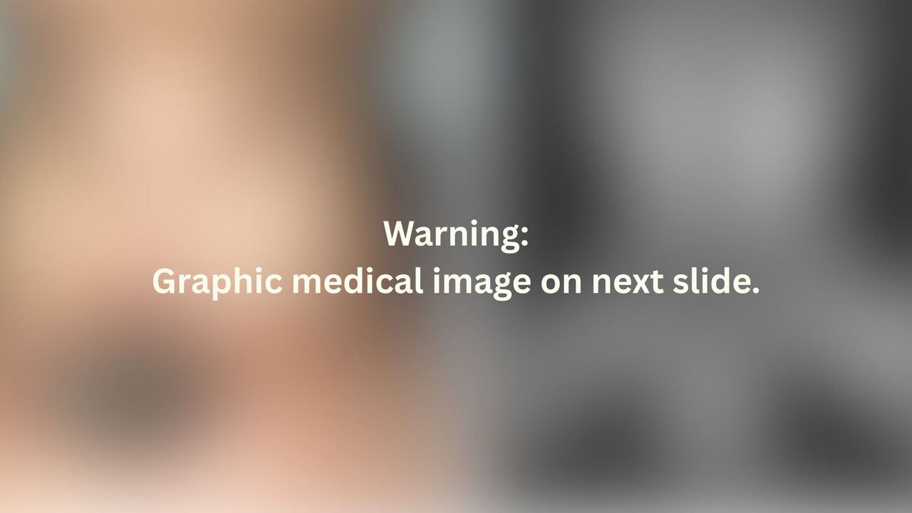 Warning slide reading "warning: graphic medical image on next slide"