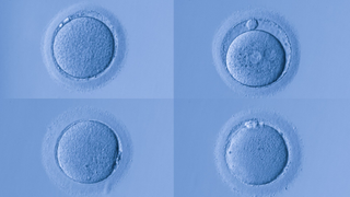 A collage of human egg cells.