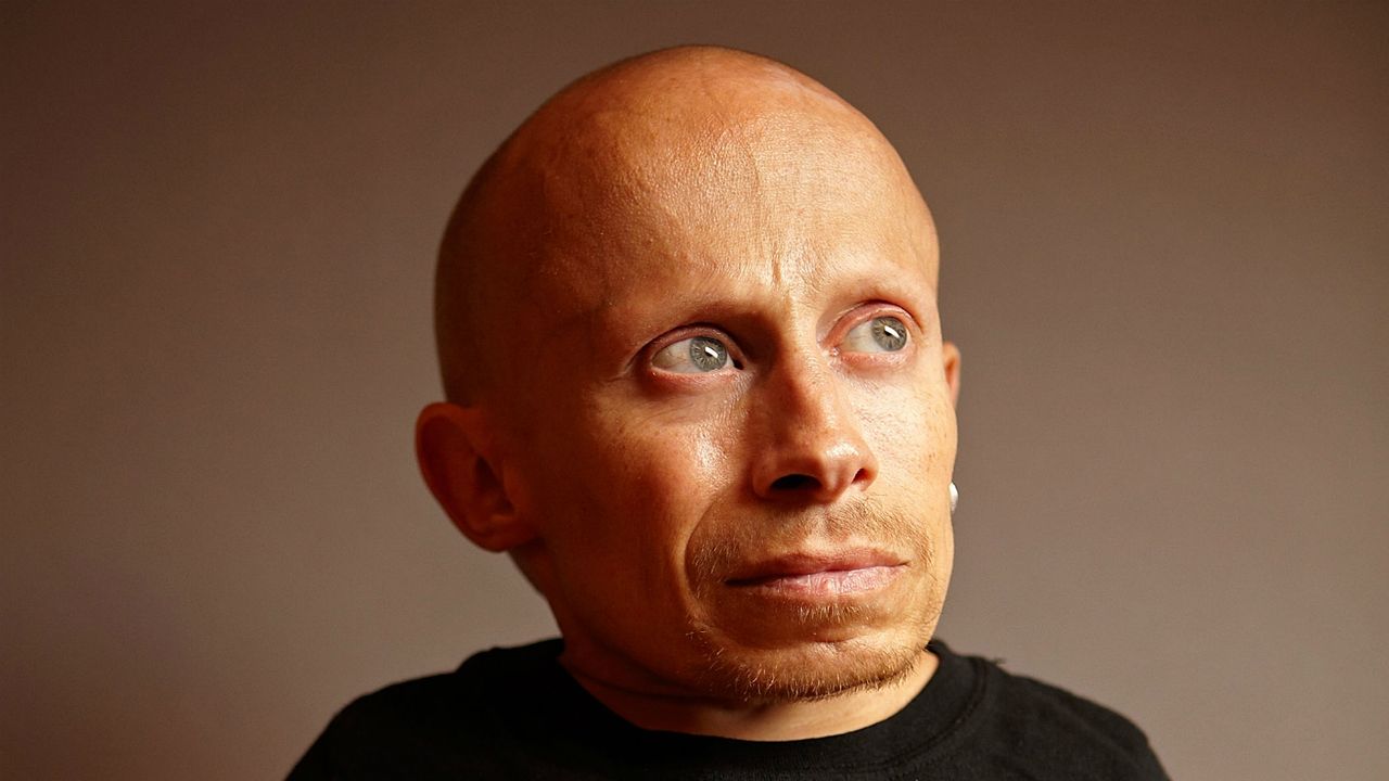 Verne Troyer