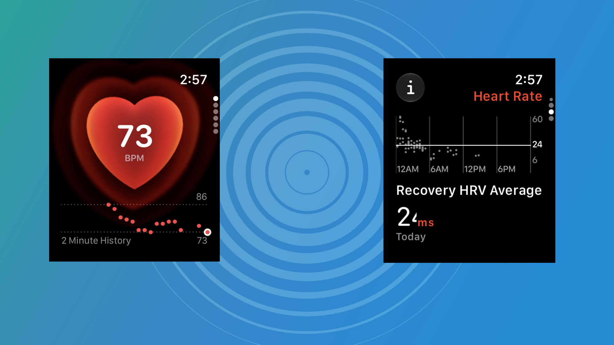 Apple Watch HRV readings