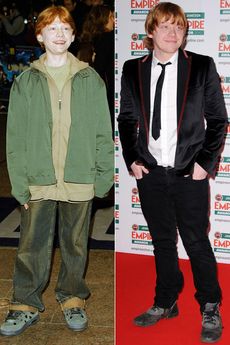 Rupert Grint - Harry Potter Stars: Then and Now - Harry Potter - Harry Potter and the Deathly Hallows - Deathly Hallows - Deathly Hallows pics - Celebrity - Marie Claire 