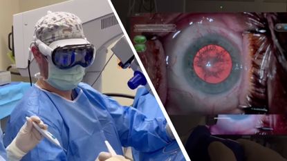 A surgeon wearing an Apple Vision Pro headset next to an in-headset view of a cataract surgery