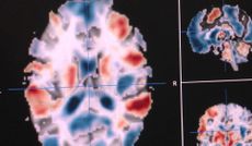 fMRI brain scan
