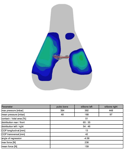 A visual output of saddle pressure mapping