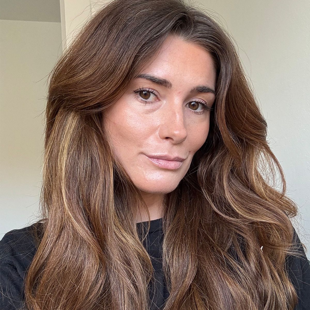 I Tried This Lifting and Sculpting Treatment As a Botox Alternative–These Are My Receipts After 3 Months