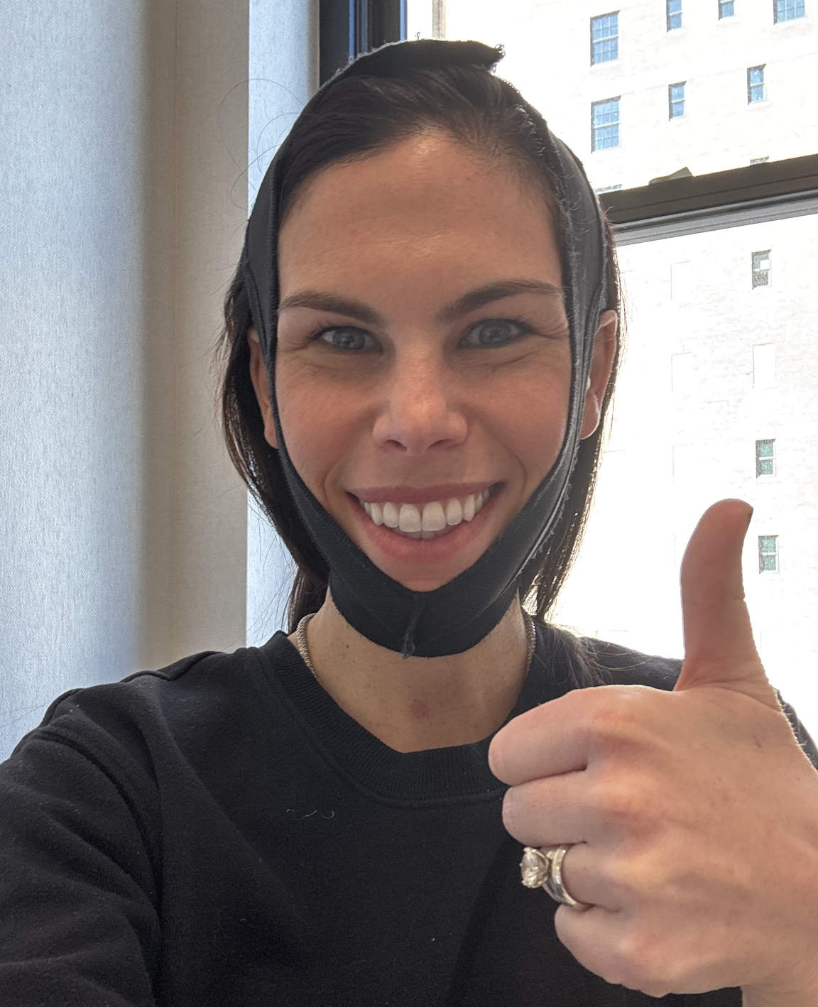 diana healing during the first week after facetite