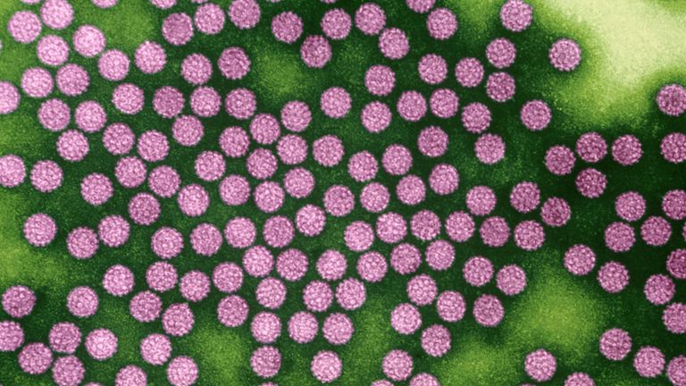 Pink, Plant, Flower, Pattern, Organism, Annual plant,