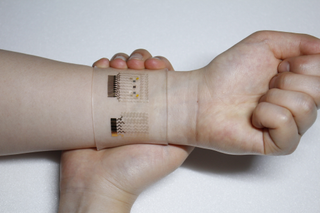 An photo of the experimental diabetes patch, on a users wrist.