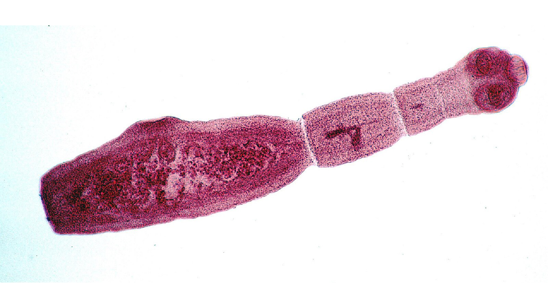 A laboratory image of an adult tapeworm