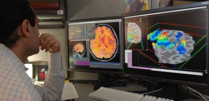 Doctor reading brain scans