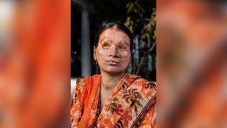 Anumukherjee was blinded and scarred in an acid attack by one of her female friends, who was jealous of her beauty