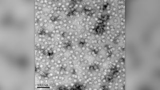 A black and white microscopic image showing virus-like protein particles