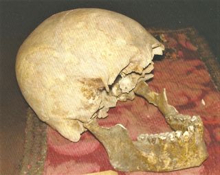 The skull and jawbone, shown together in in the museum.