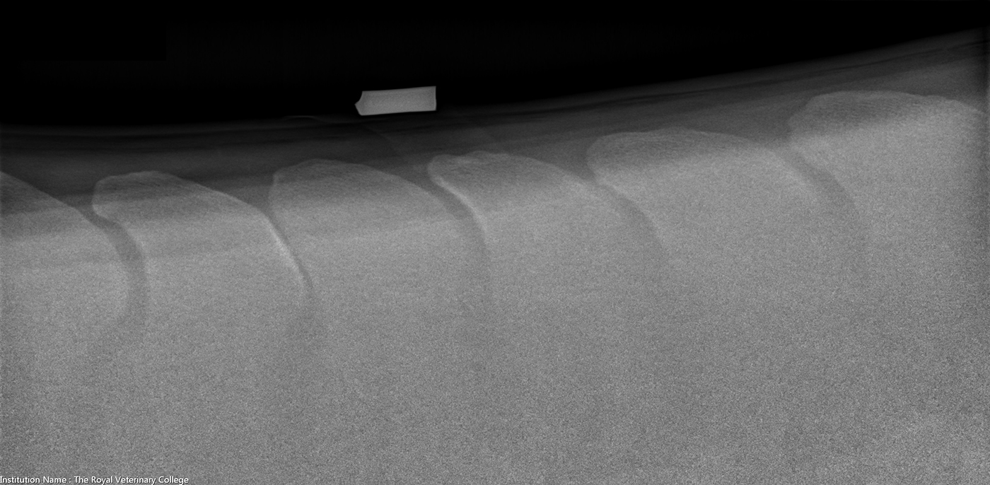 Before-kissing-spines-surgery