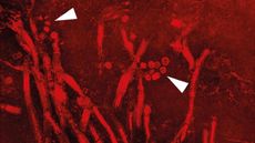 Microscopic image dyed red showing circular spores of the fungus