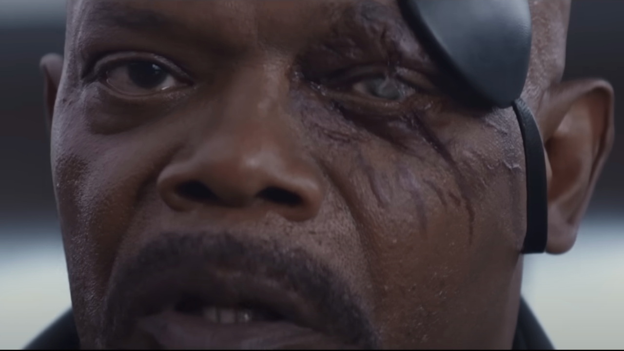 Samuel L Jackson shows off his injured eye in Captain America: The Winter Soldier.