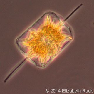 The diatom Ditylum.