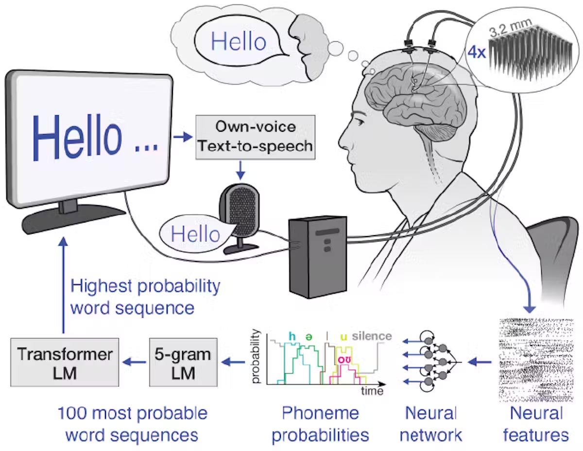 Um diagrama mostrando como o dispositivo transforma sinais neurais em fala por meio de um computador, mostrando uma série de setas que vão do cérebro através de uma rede neural até uma tela de computador