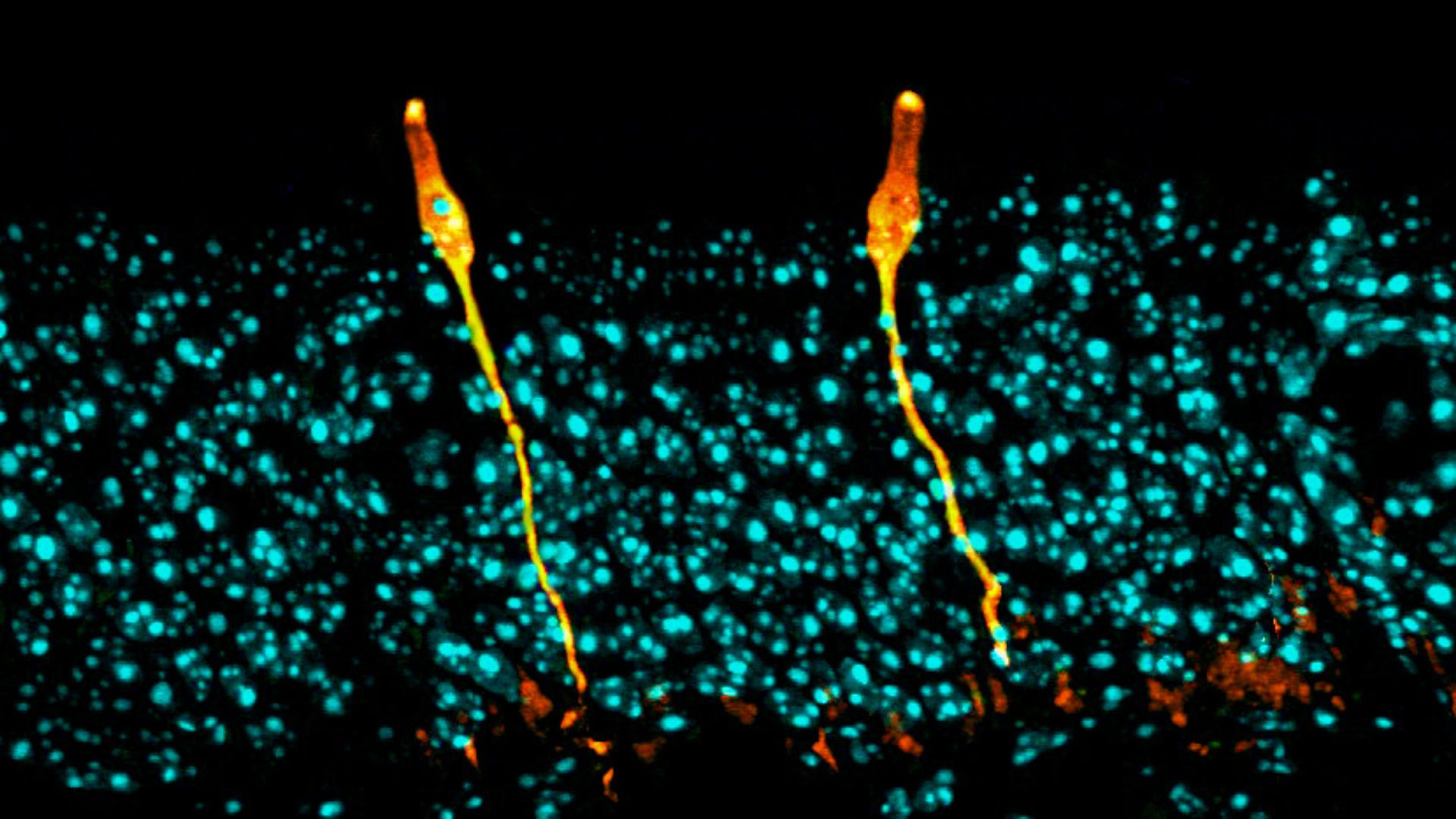 light blue dots representing cells have two, long yellow cells extending through their midst