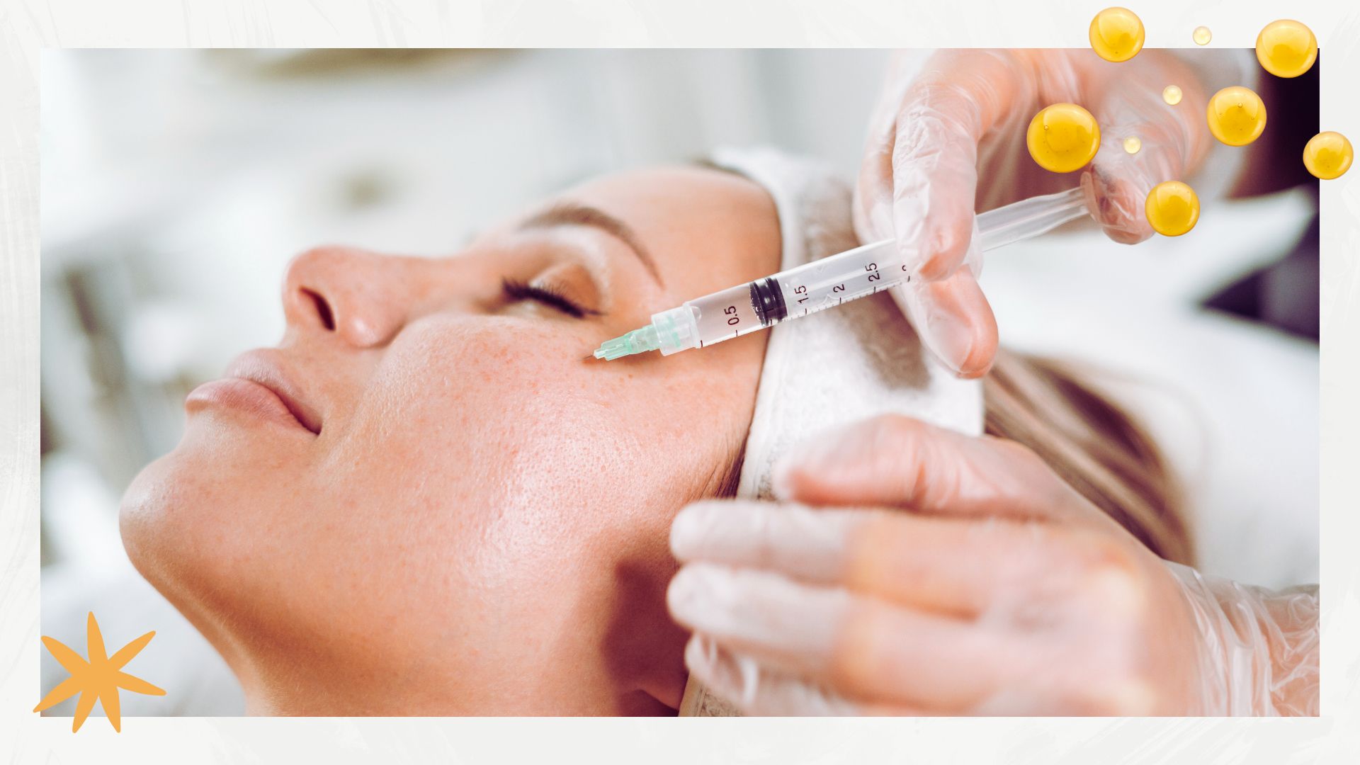 model having injectable tweakment to illustrate Botox vs filler