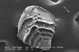 The single-celled organism <em>Stensioeina beccariiformis</em> survived the mass extinction that killed the dinosaurs but went extinct 56 million years ago, when the oceans acidified due to a massive carbon dioxide release. 