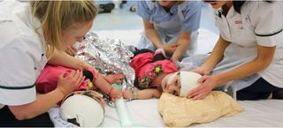 Twins Safa and Marwa Ullah were born with an extremely rare condition called craniopagus, which means they were connected at the head and shared a portion of their skull and brain tissue. Above, an image of the twins after their separation surgery.