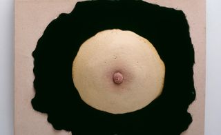 An image of a breast