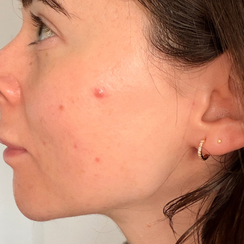 Grace's skin before using the hero mighty patch