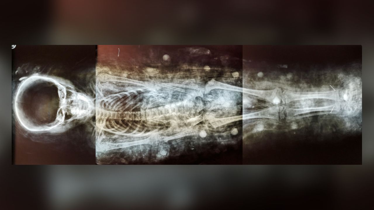 An X-ray of the boy's mummy, taken in 1984.
