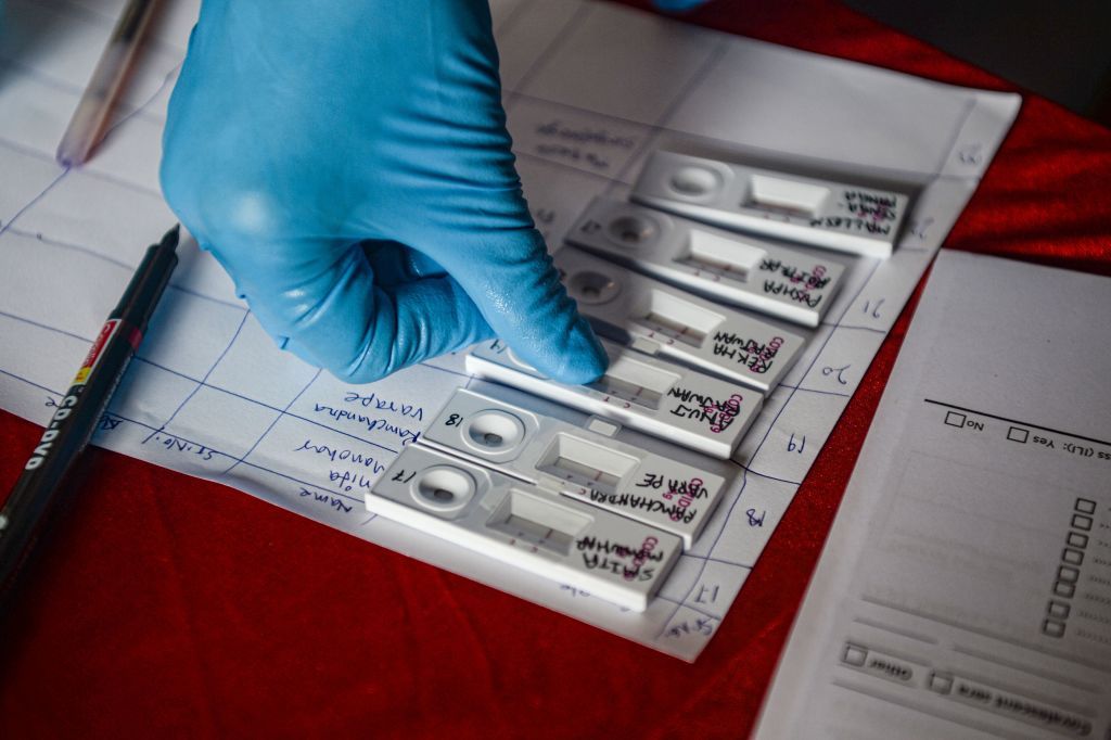 Coronavirus antigen test.