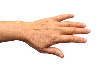 A woman's hand, with age spots