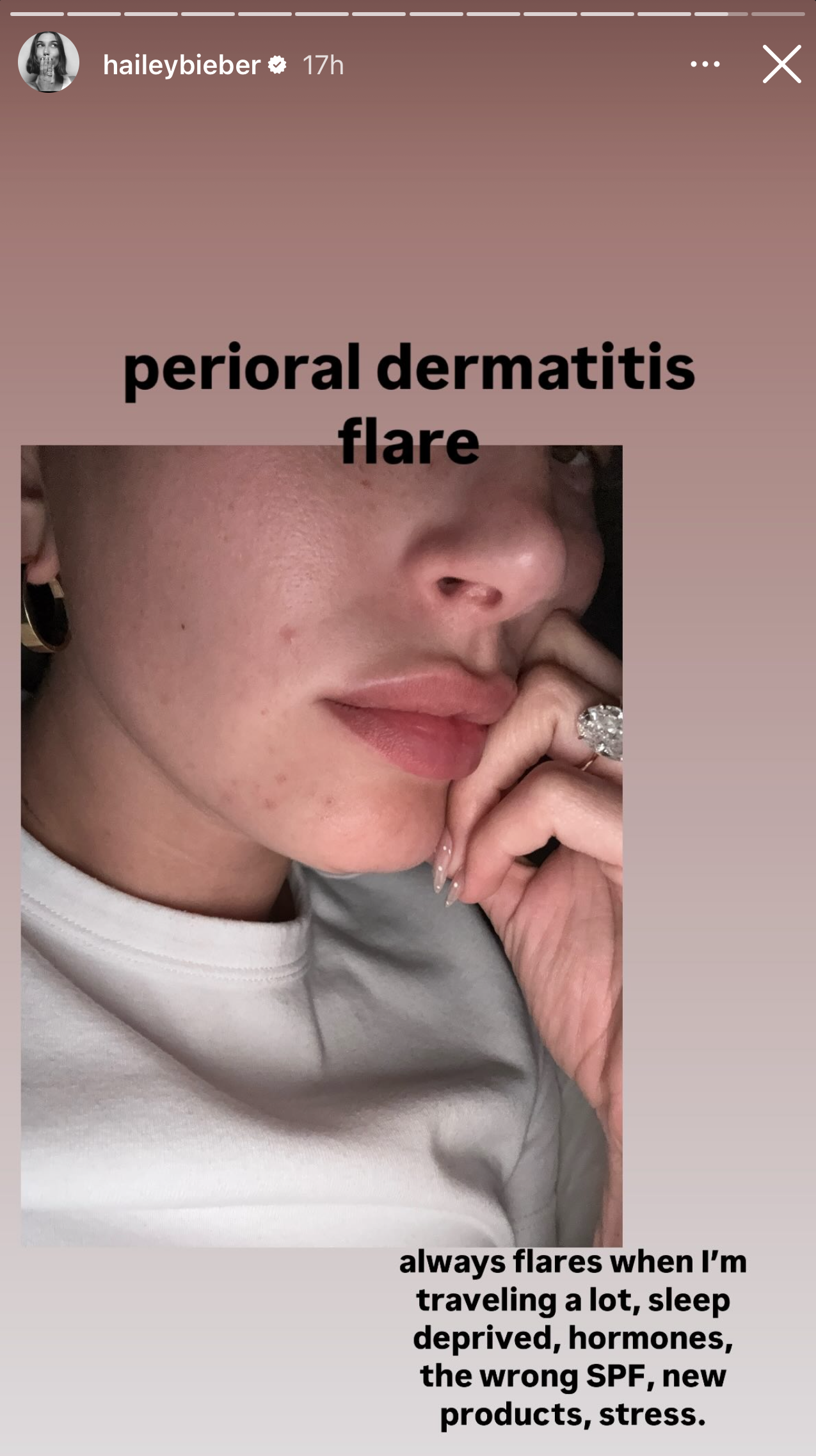 a close up photo of a mouth with blemishes surrounding it