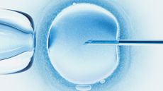 an illustration of a needle piercing a round cell