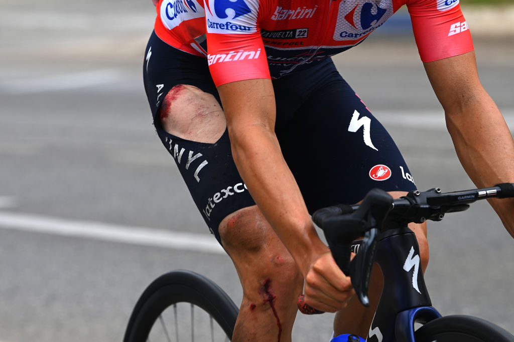ESTEPONA SPAIN SEPTEMBER 01 Detail view of Remco Evenepoel of Belgium and Team QuickStep Alpha Vinyl Red Leader Jersey competing injured after being involved in a crash during the 77th Tour of Spain 2022 Stage 12 a 1927km stage from Salobrea Peas Blancas Estepona 1260m LaVuelta22 WorldTour on September 01 2022 in Estepona Spain Photo by Tim de WaeleGetty Images