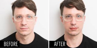 Before and after of a man who had his lips overlined
