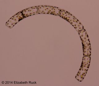 The diatom Guinardia.