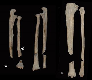 Cut marks on the bones of the skeletons found in a medieval grave suggest a barbaric amputation was carried out.