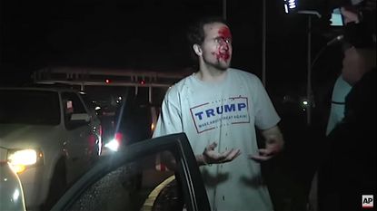 A Donald Trump supporter is wounded outside Southern California protest