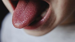 Should you brush your tongue: image of child sticking out tongue
