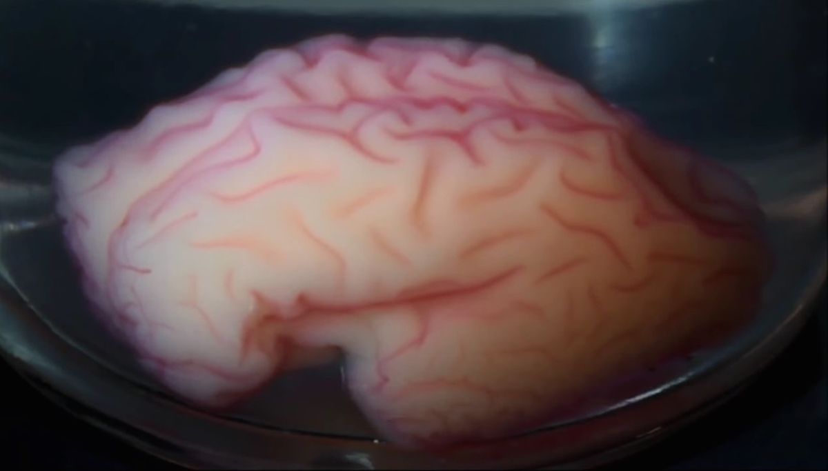 Scientists created a physical model of a human brain and stuck it into a vat of solvent, watching it develop and morph a wrinkly organ.