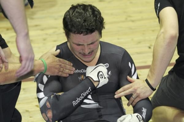 Ouch! Eddie Dawkins with the injuries he sustained in the crash during the keirin.