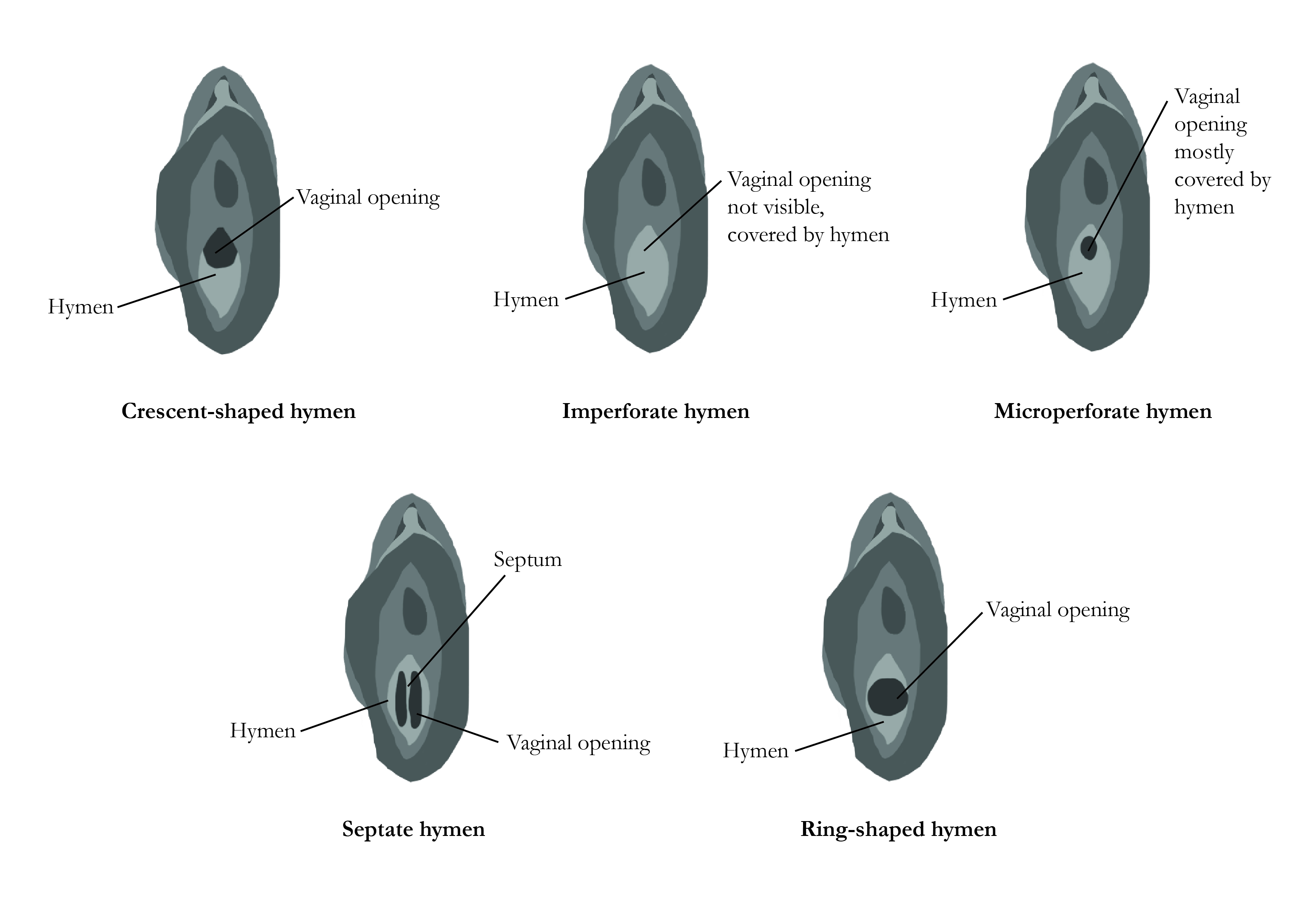 What Does A Normal Vagina Look Like A No Nonsense Guide To Vaginas And What Does A Normal Vagina Look Like A No Nonsense Guide To Vaginas And